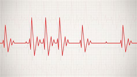 An irregular heart beat Figgerits Answer .